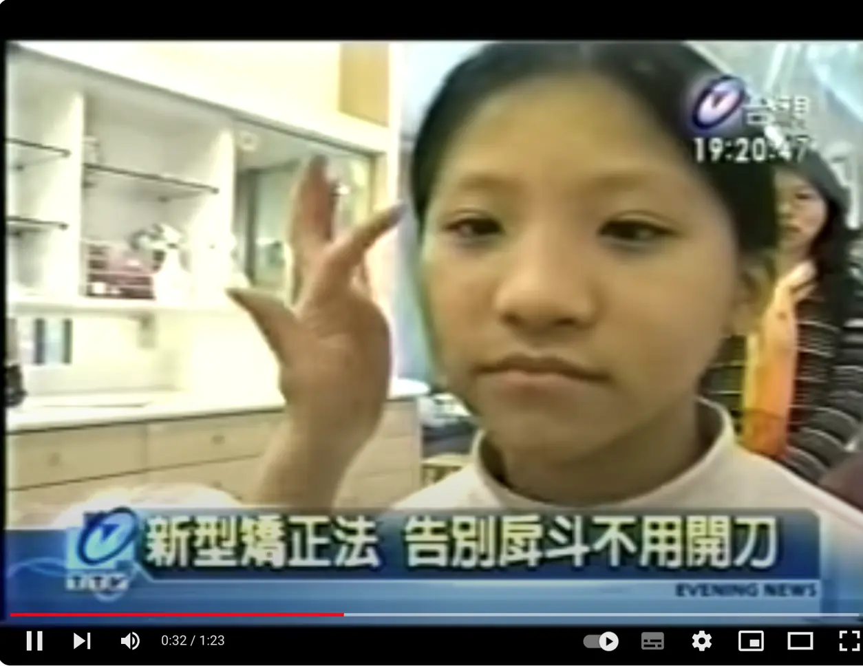 戽斗矯正 - 兒童早期生長導引 戽斗矯正 - 兒童早期生長導引